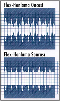 flex-honlama